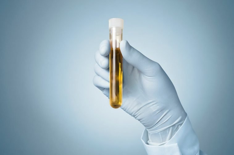 Cholestasis Symptoms, Types, Diagnosis & Treatment Page 2 of 13